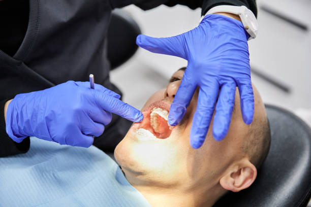 Best Urgent Care for Lost Fillings or Crowns in North Lynnwood, WA
