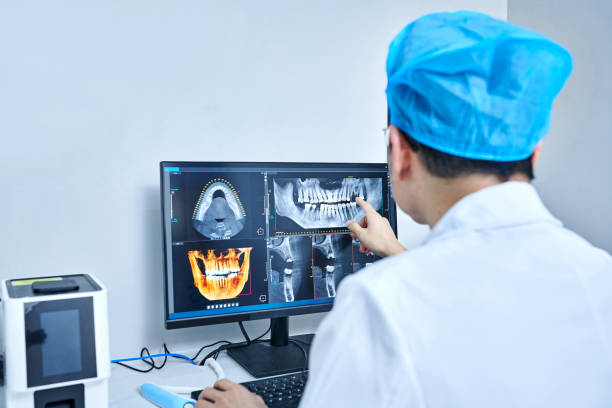 Best Emergency Root Canal Treatment in North Lynnwood, WA